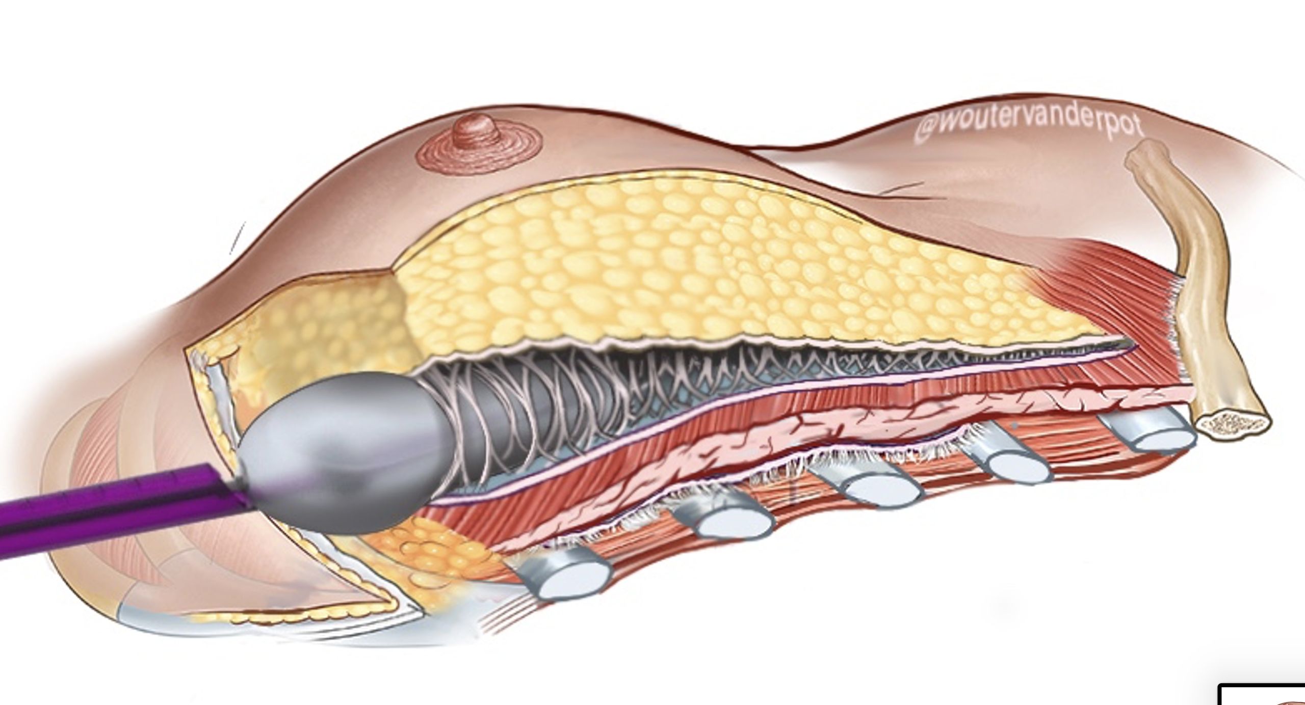 Scherm­afbeelding 2025 12 10 om 18.18.10