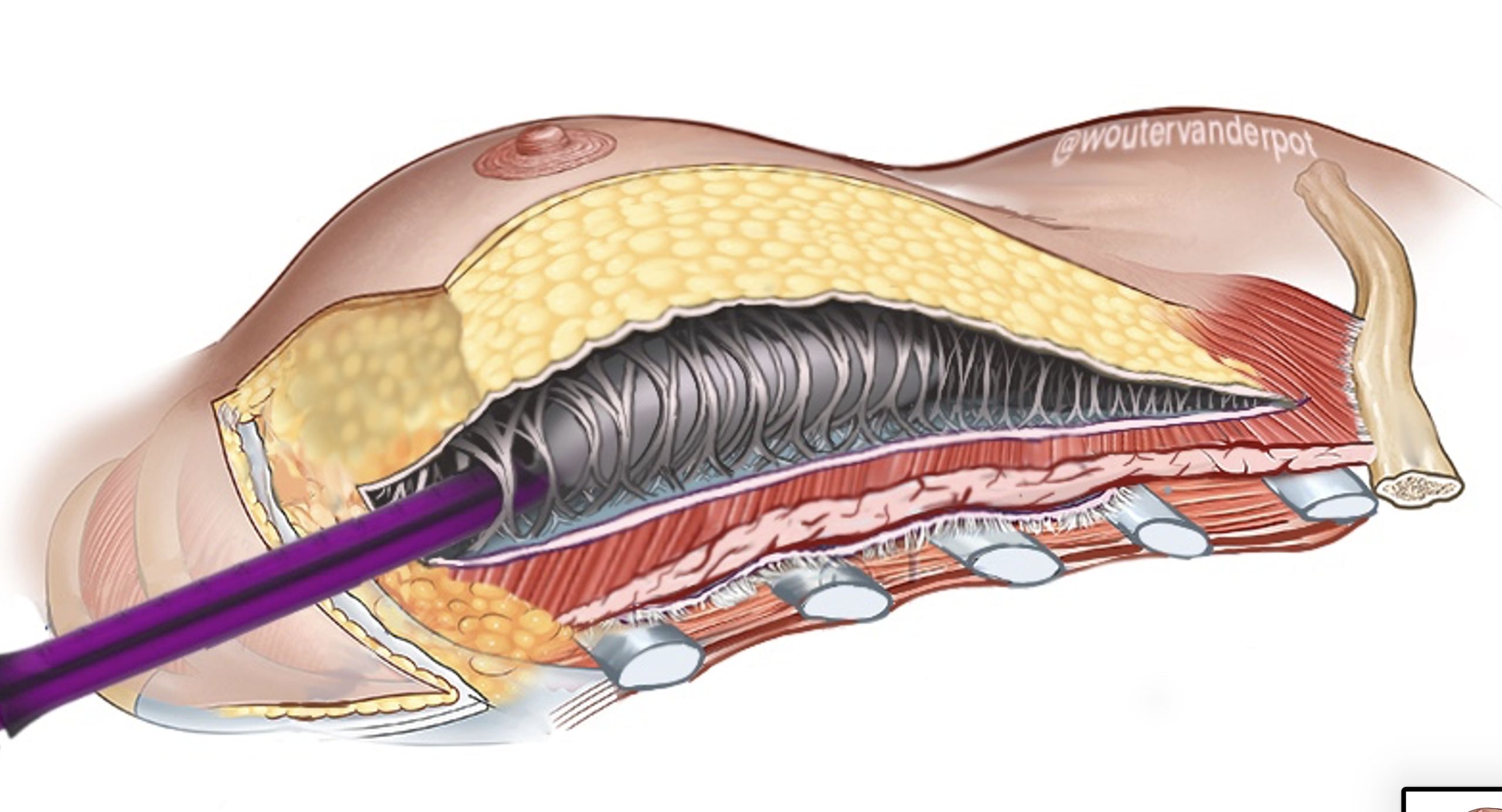 Scherm­afbeelding 2025 12 10 om 18.18.14